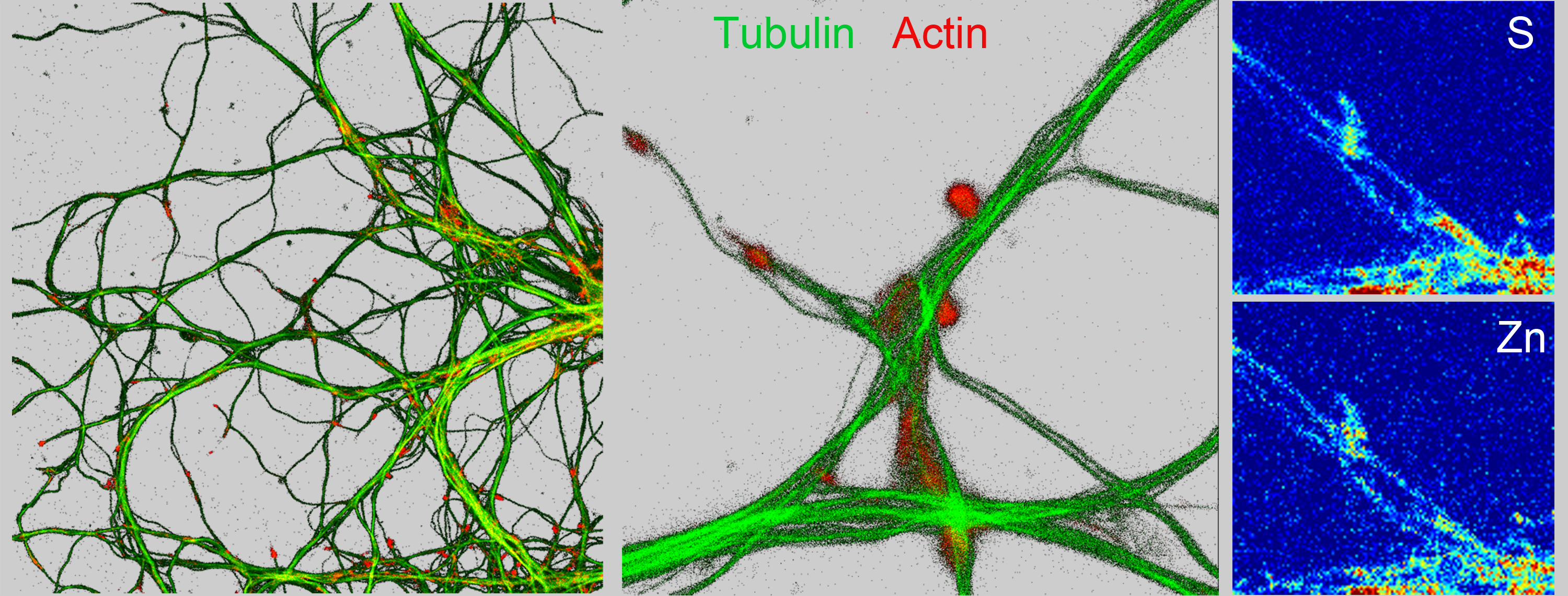 Nano-imagerie de la tubuline et de l’actine, du soufre et du zinc, de dendrites et compartiments synaptiques de neurones de l’hippocampe.
