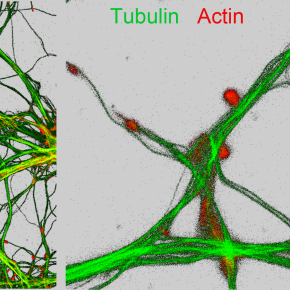 Nano-imagerie de la tubuline et de l’actine, du soufre et du zinc, de dendrites et compartiments synaptiques de neurones de l’hippocampe.